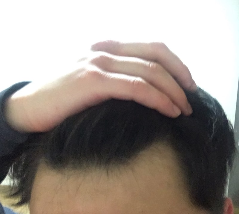 이마3.jpg