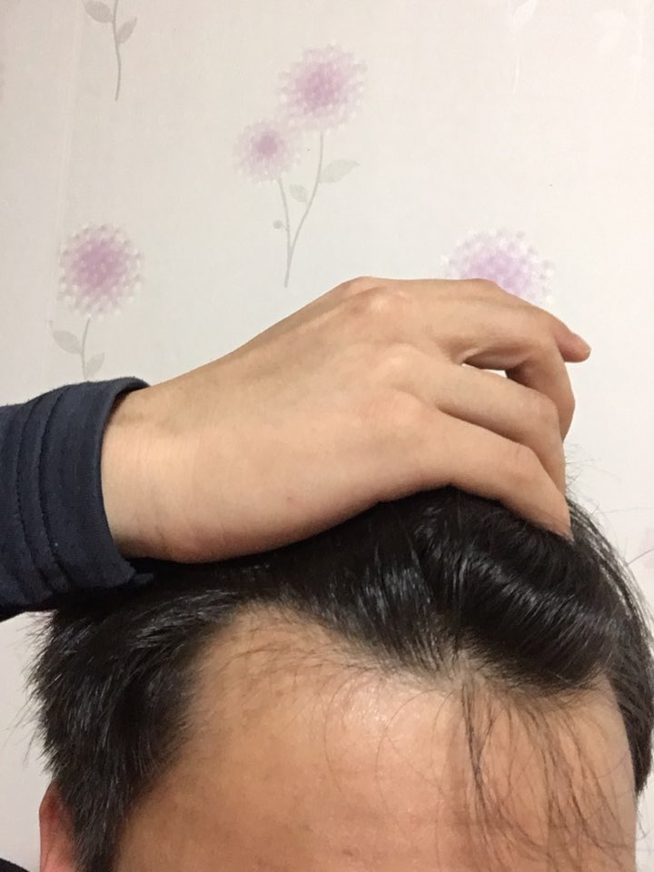 이마1.jpg