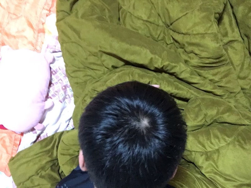 정수리6.jpg