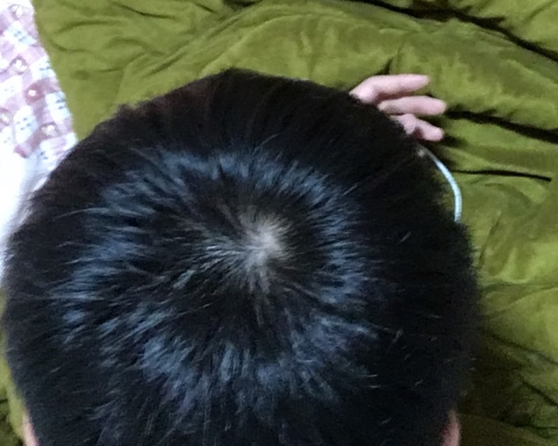 정수리5.jpg