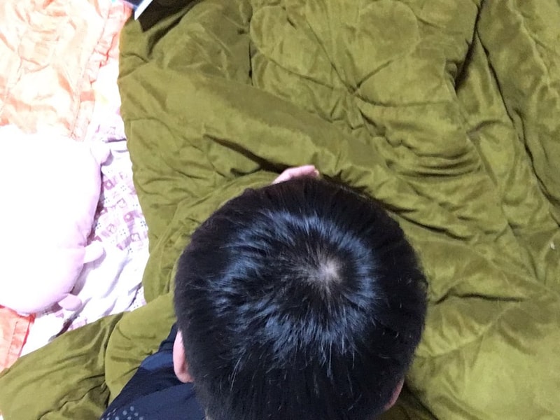 정수리2.jpg