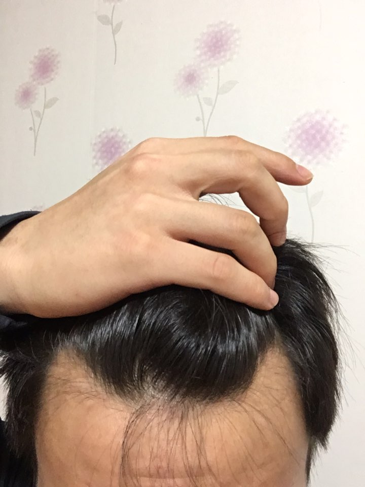 이마3.jpg