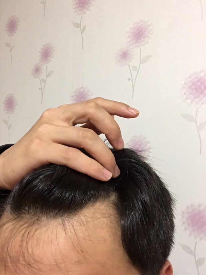 이마2.jpg