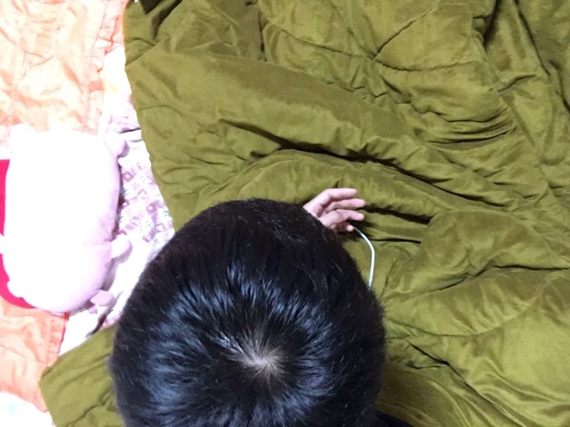 정수리3.jpg