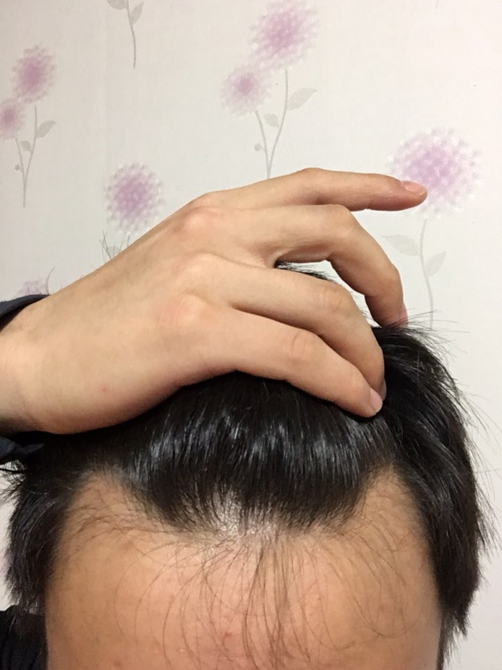 이마4.jpg