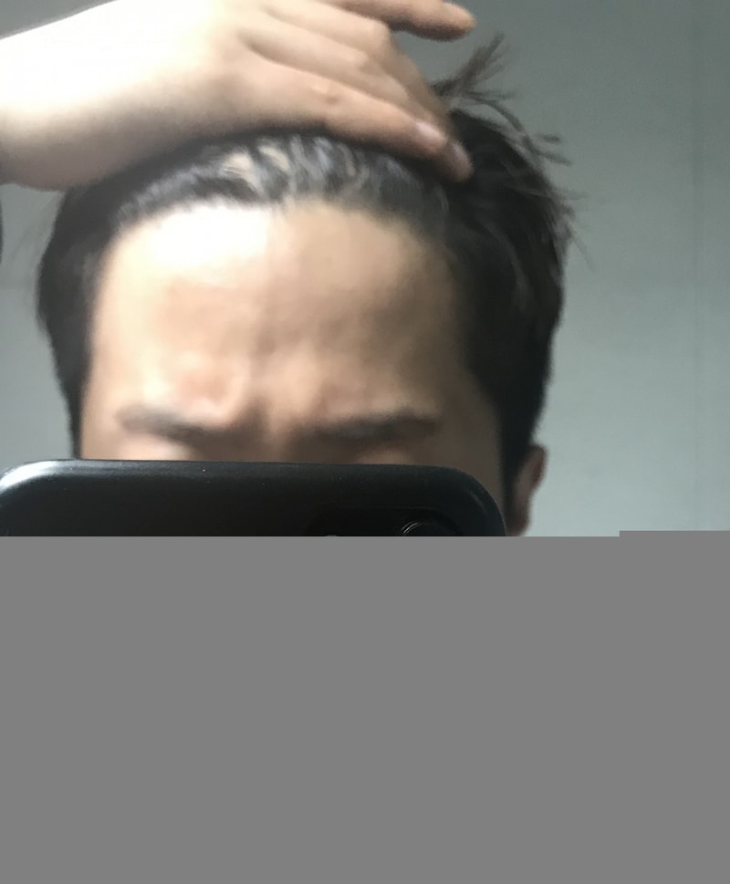 이마.jpg