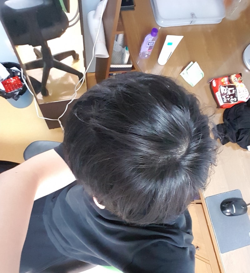 정수리2.jpg