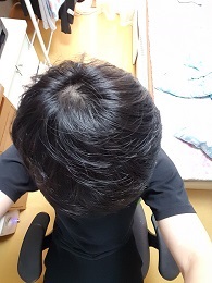 정수리1.jpg