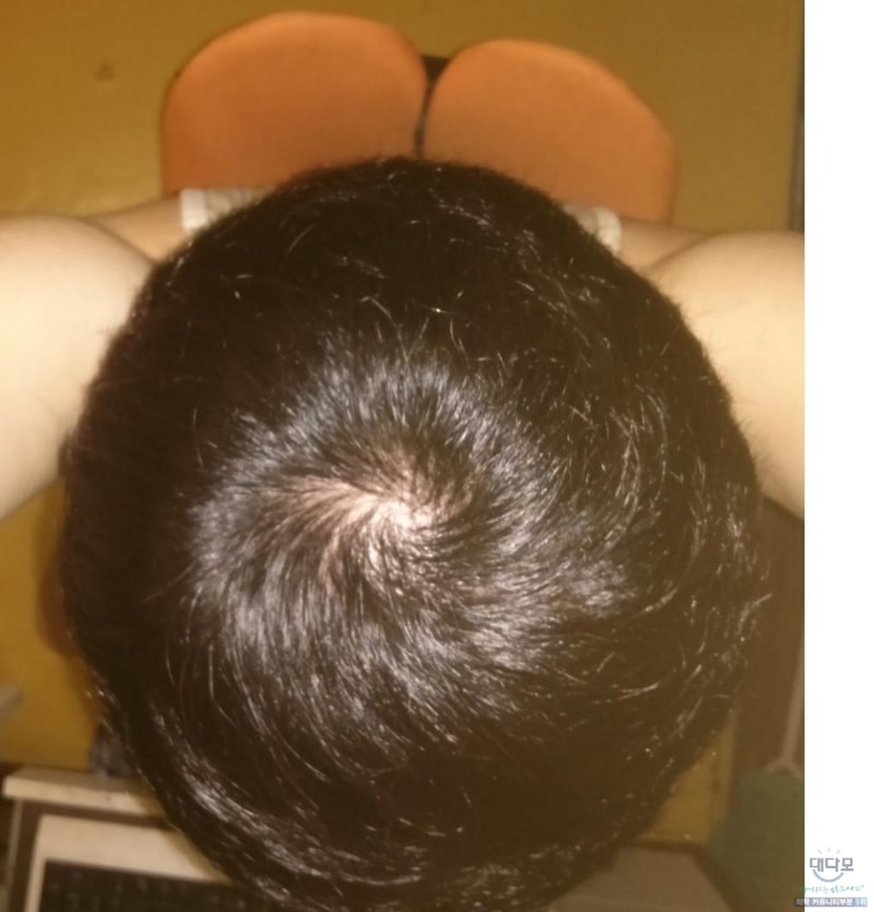 오늘임2.jpg