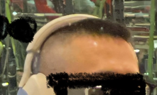 속는 셈 치고 사본 탈모 샴푸 후기