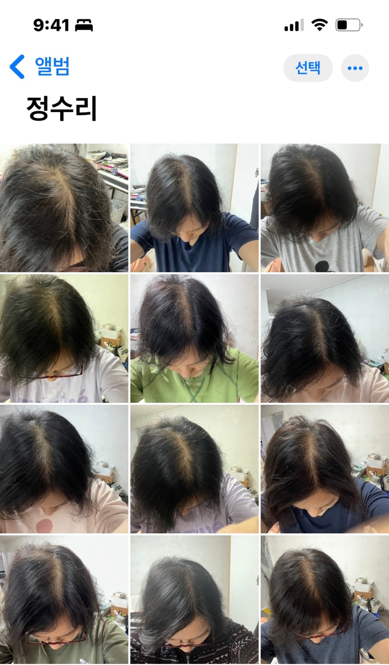 리피나12 사용후기입니다