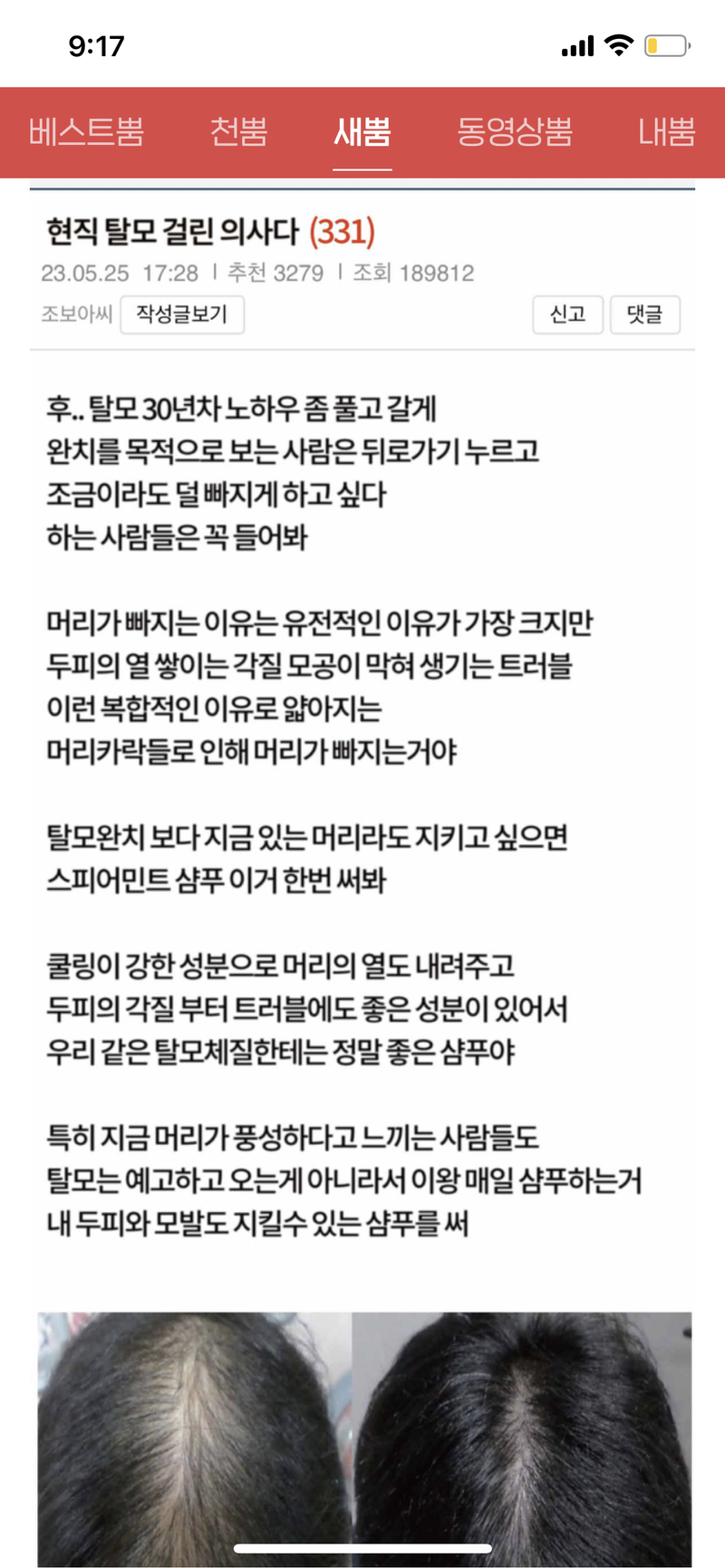 스피어민트 샴푸 써보신 분 계신가요?