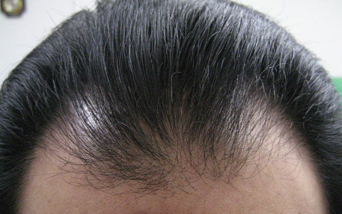 곽정면110.3.25.JPG