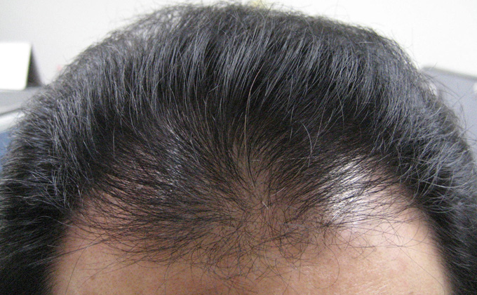 곽정면4 10.3.9.jpg
