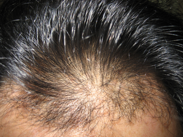 vitalmohdm7.jpg