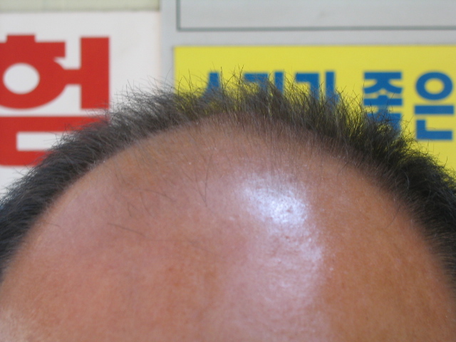 김영철06년5월3일정면1.JPG