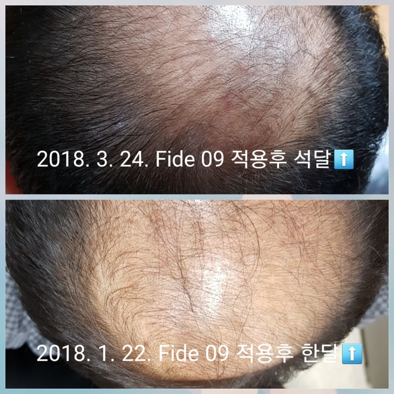 의약품이 아닌 화장품의 제품후기입니다.