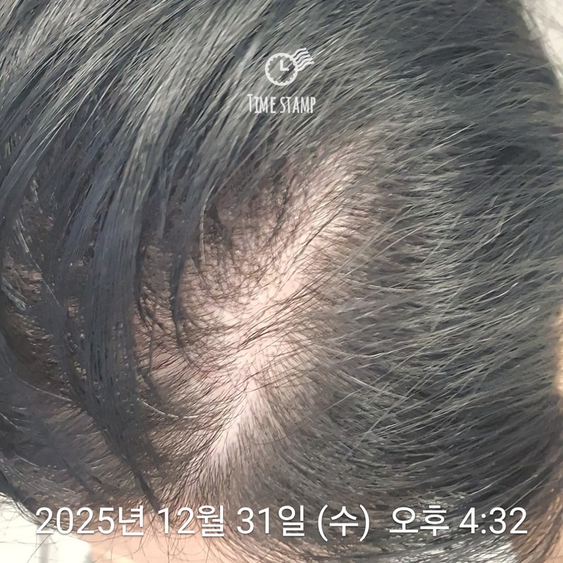 TS어성초 카밍샴푸 후기!