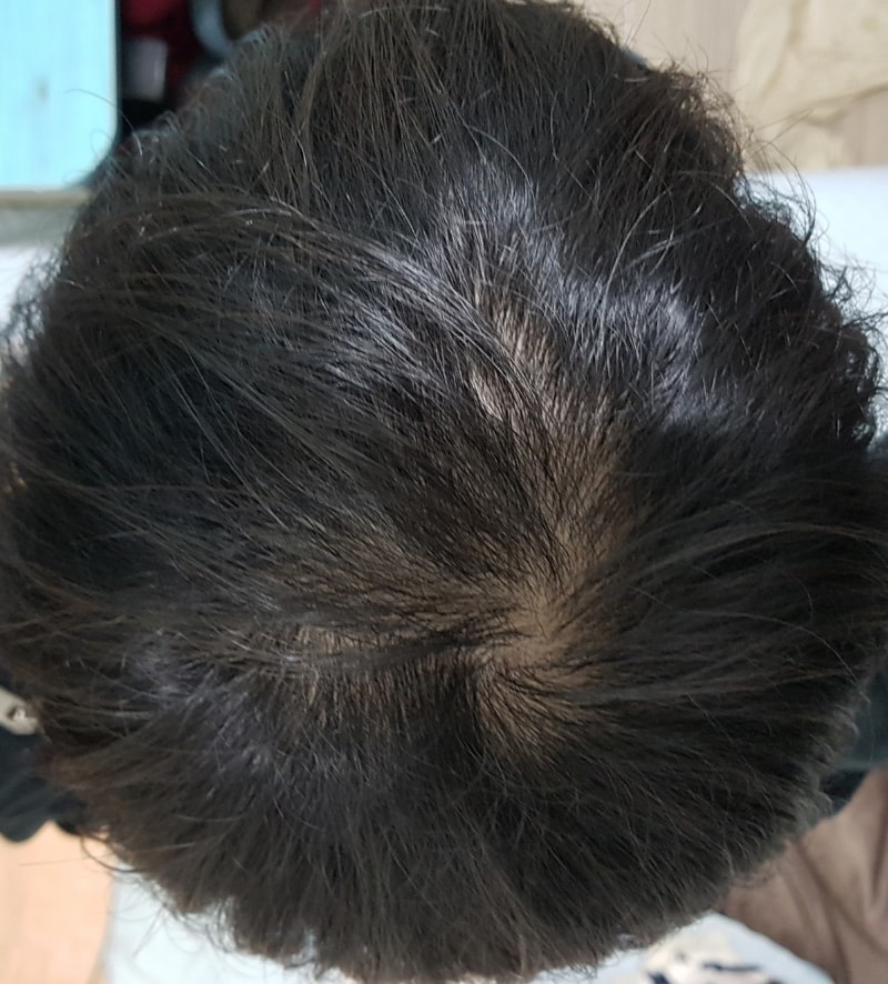 회원님들은 일주일에 몇 번 정도 흑채 사용하세요?