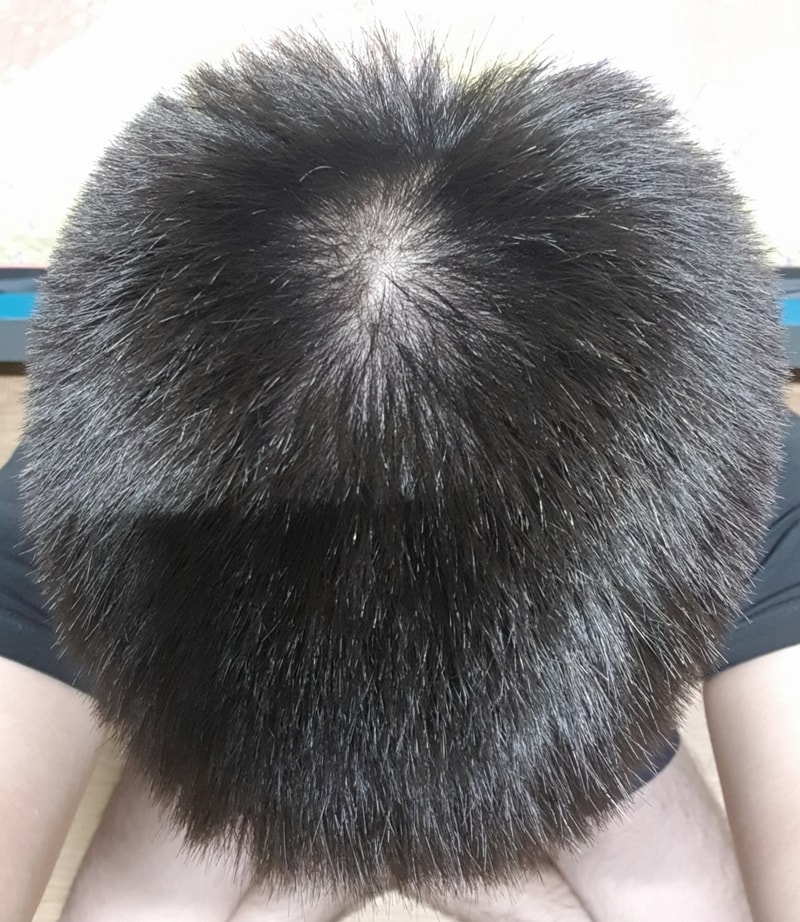 트리트먼트 사용법