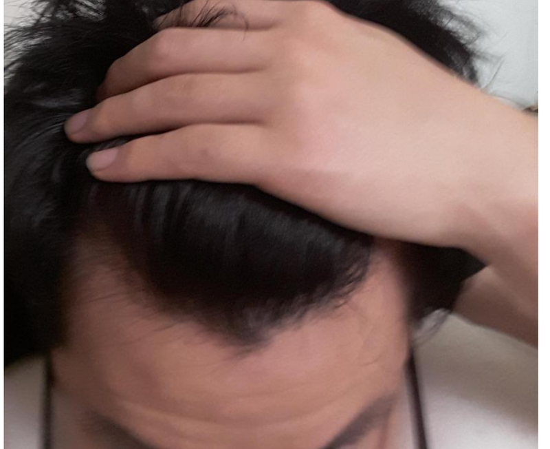 영양제를 먹고 있는데 효과가 없는거 같습니다