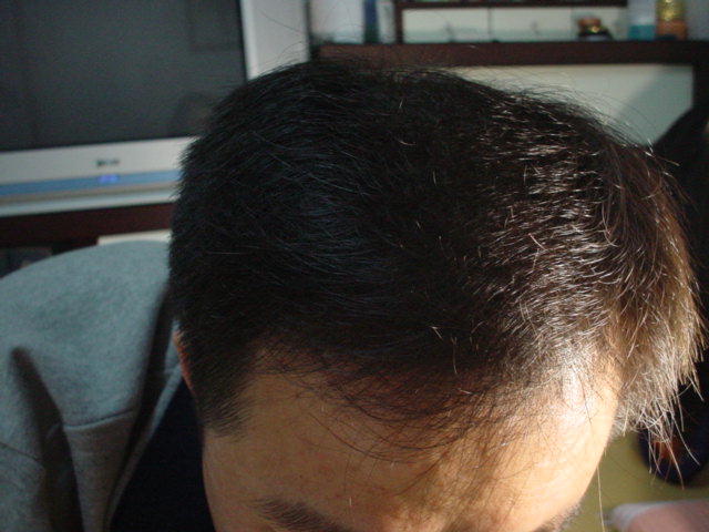 after.jpg