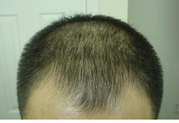 before.JPG