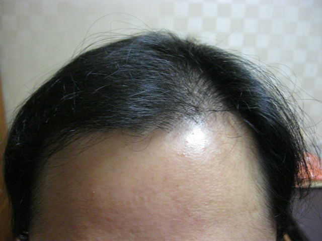 20110104 008.jpg