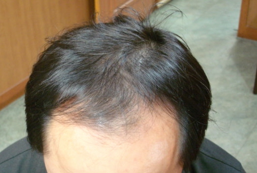 치료전1.jpg