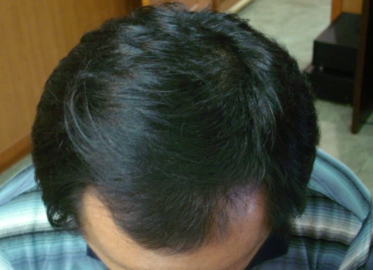 치료후2.jpg