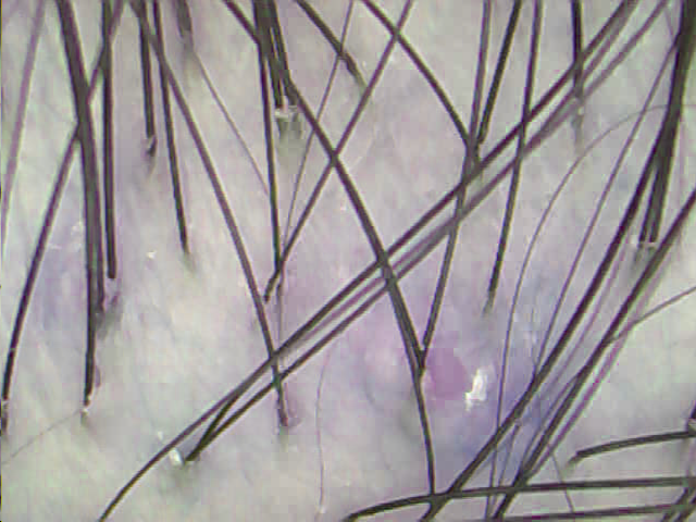 2.bmp
