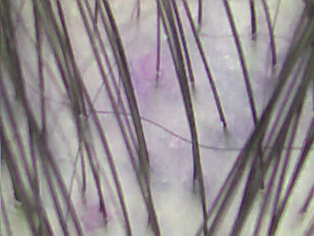 5.bmp