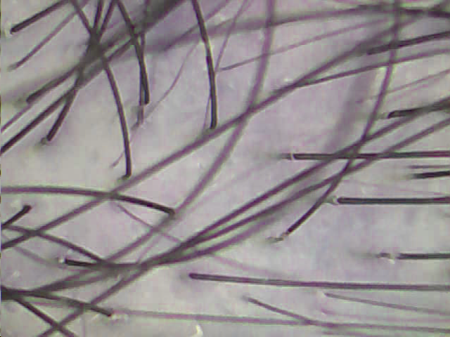 3.bmp