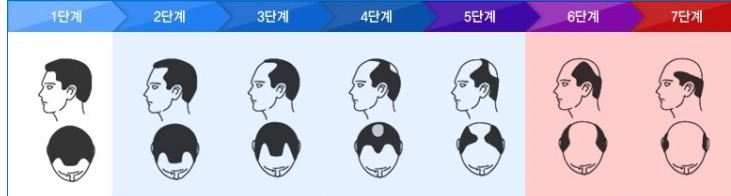 bb.jpg