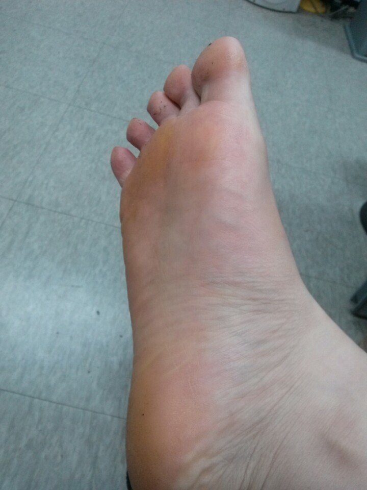오른쪽발.jpg