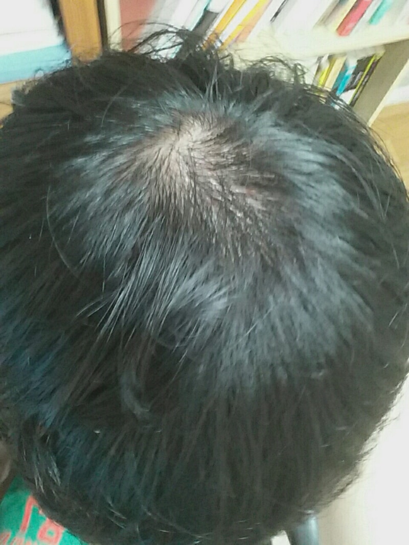 KakaoTalk_20160722_235750942.jpg