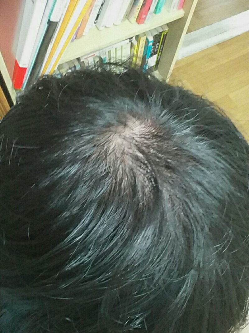 KakaoTalk_20160722_235753362.jpg