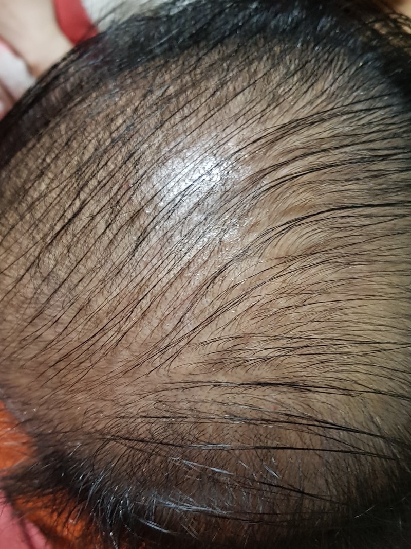 20180309_215919.jpg