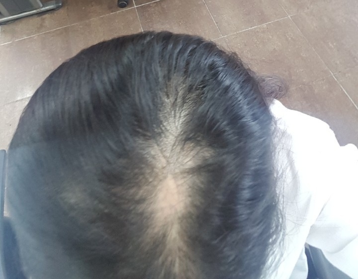 KakaoTalk_20170619_081538434.jpg