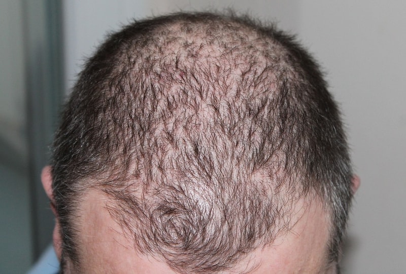 hair-248050_1280.jpg
