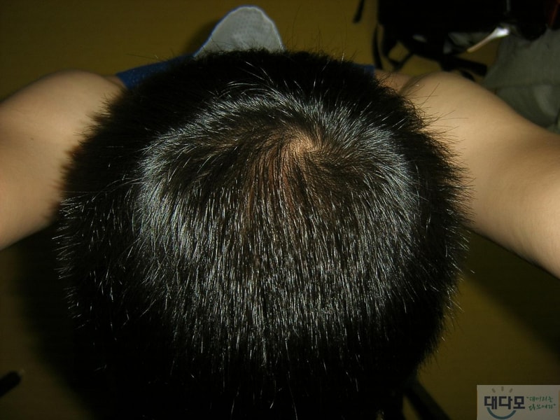 프카5개월20일미녹50일.JPG