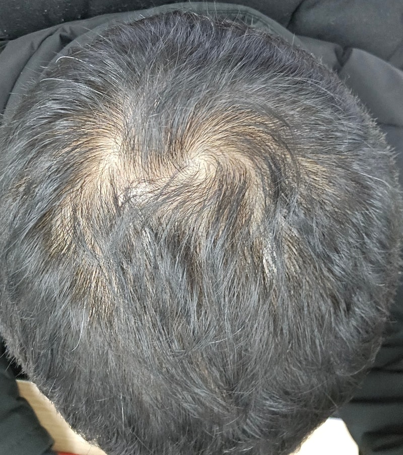 전.jpg