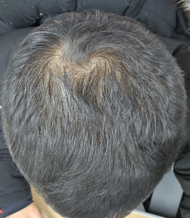 후.jpg