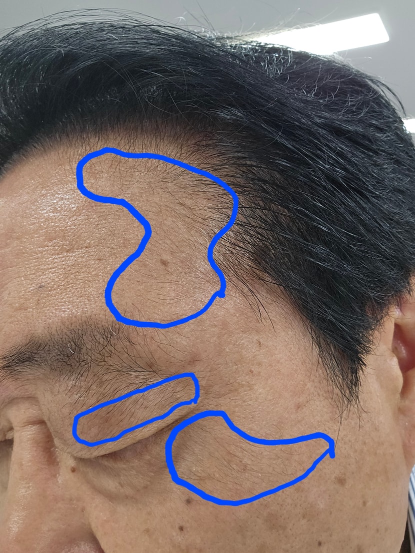 잔털 및 솜털