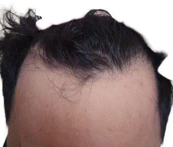 1000024242.png