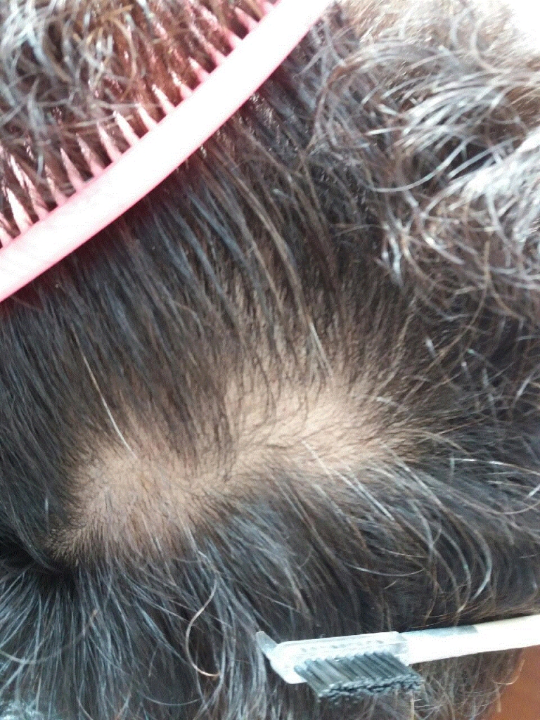 Resized_20180415_072118.gif