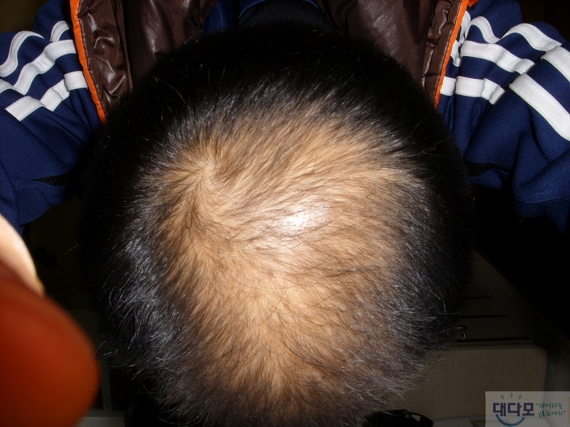 STP80002.JPG