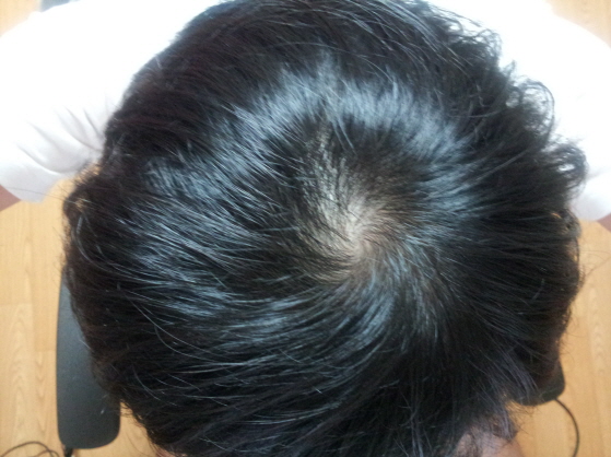 크기변환_2011-11-08 22.50.55.jpg