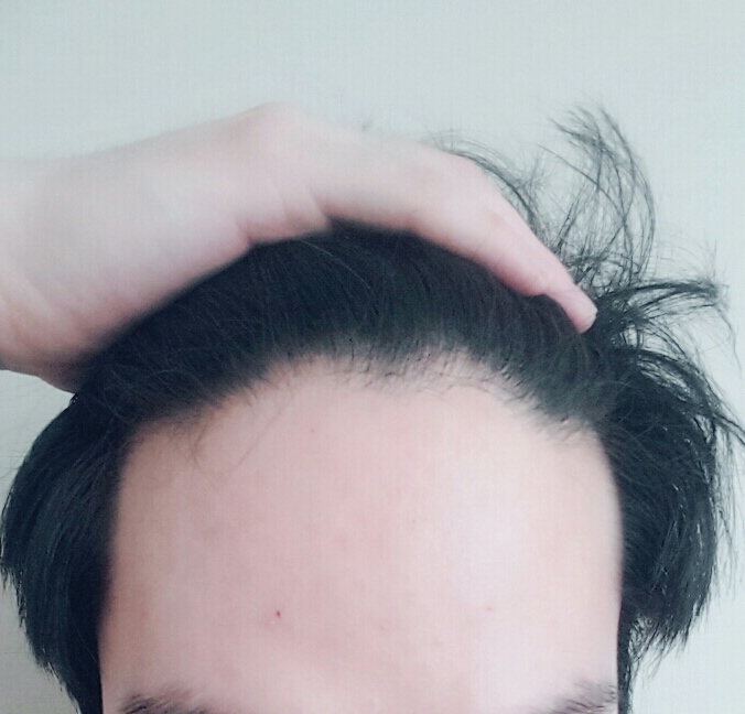 B612_20170415_091033-1-1.jpg
