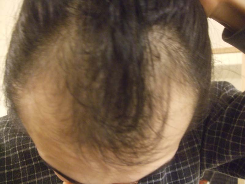2010-0102.jpg